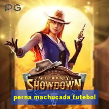 perna machucada futebol